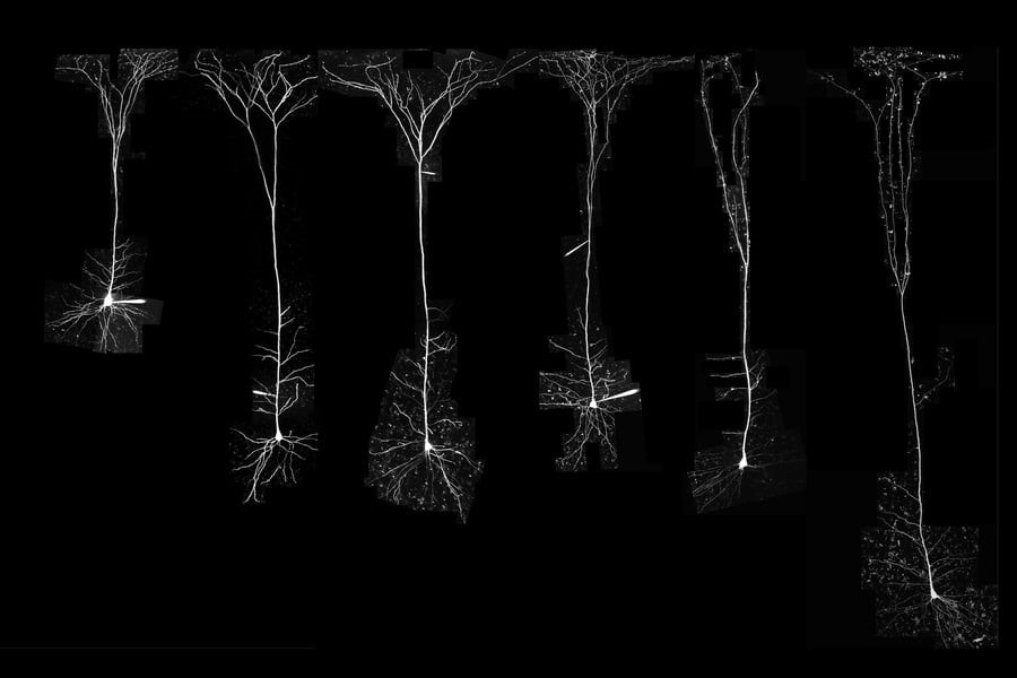 Neurowetenschappers analyseerden de neuronen van verschillende zoogdiersoorten, waaronder (van links naar rechts) fret, cavia, konijn, zijdeaapje, makaak en mens. Afbeelding: Beaulieu-Laroche et. al.